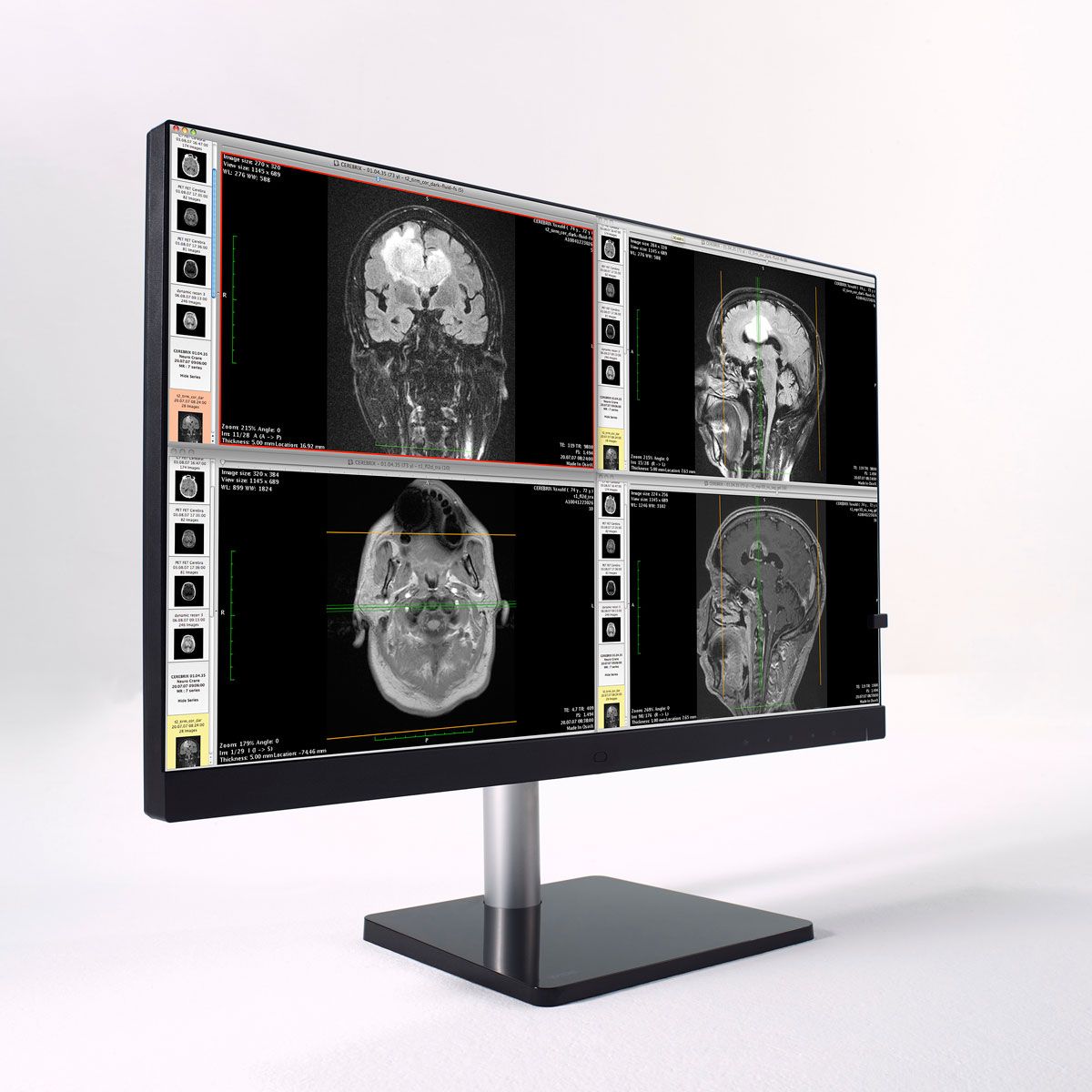 WIDE CL24N 2MP Clinical Review Display Monitor