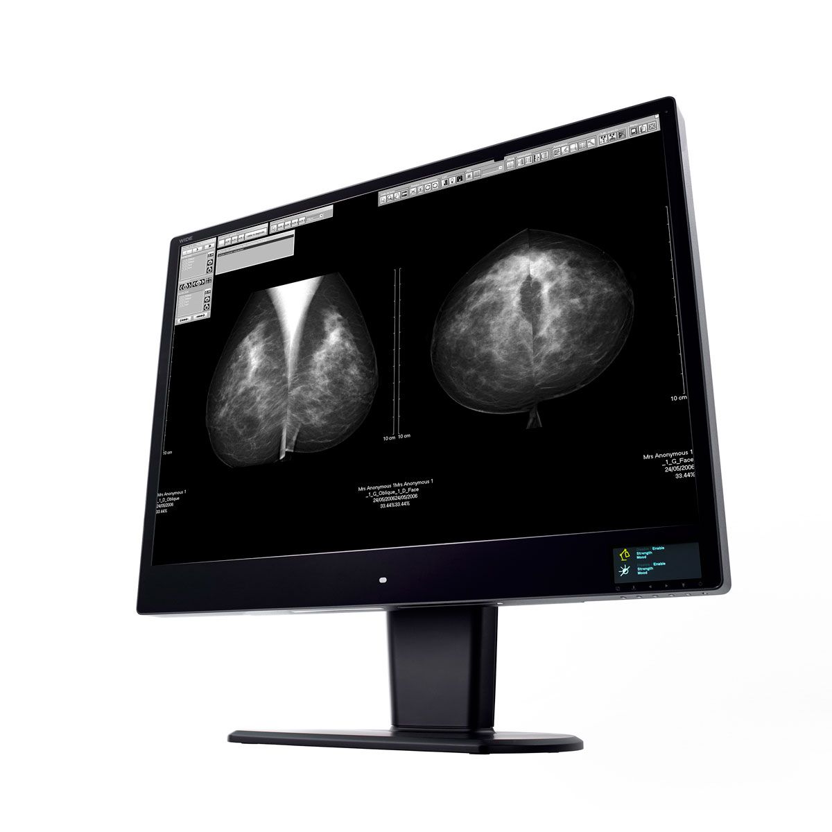 WIDE CW120N 12MP Diagnostic Radiology Monitor