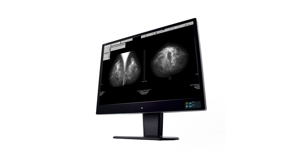 WIDE CW120N 12MP Diagnostic Radiology Monitor