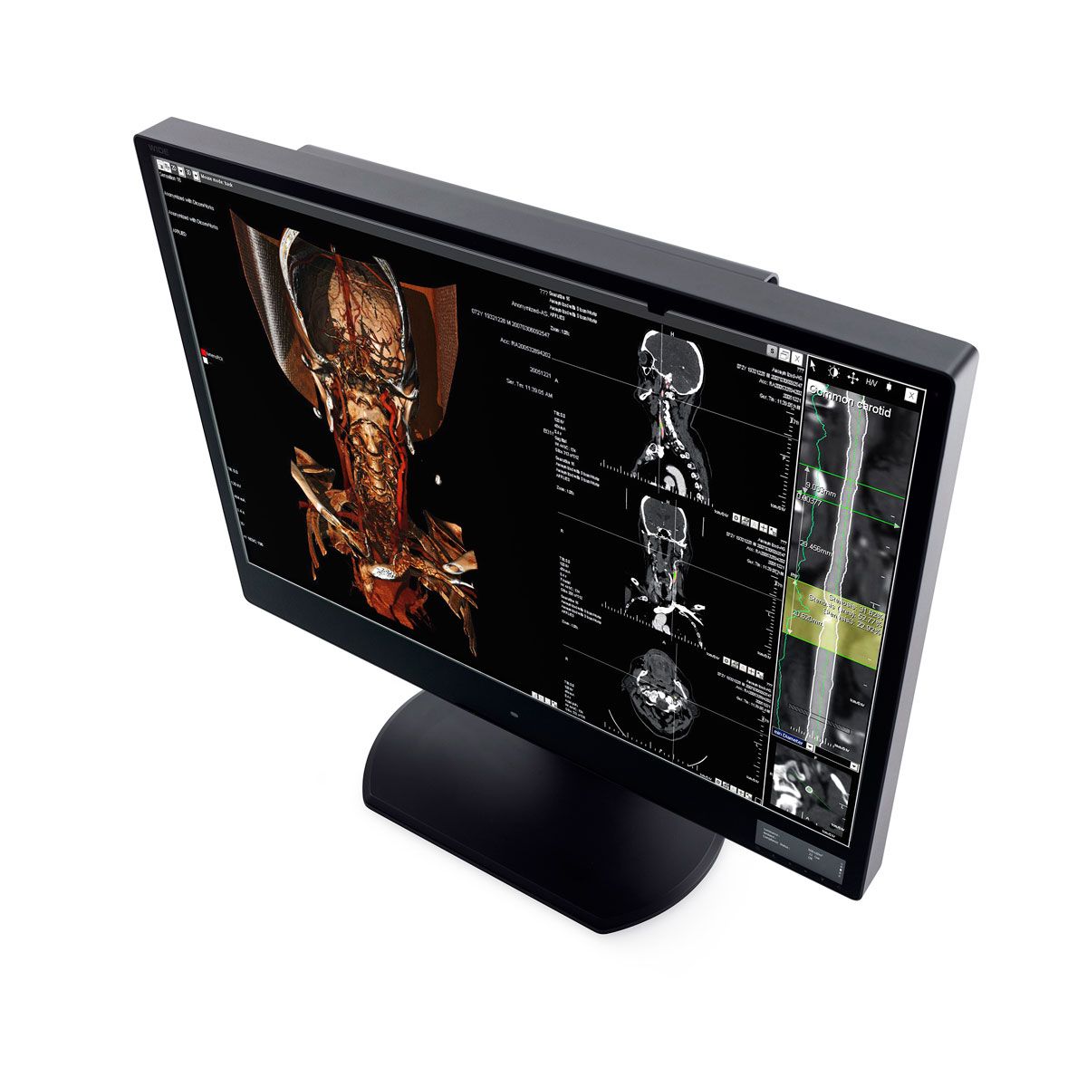 WIDE CW60N 6MP Diagnostic Radiology Monitor