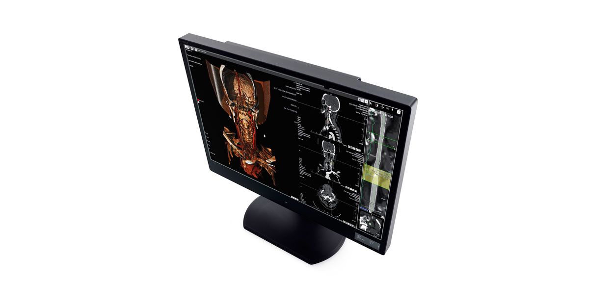 WIDE CW60N 6MP Diagnostic Radiology Monitor