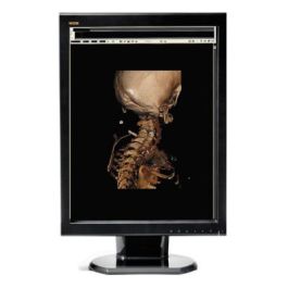 WIDE CX20 2MP Diagnostic Radiology Monitor