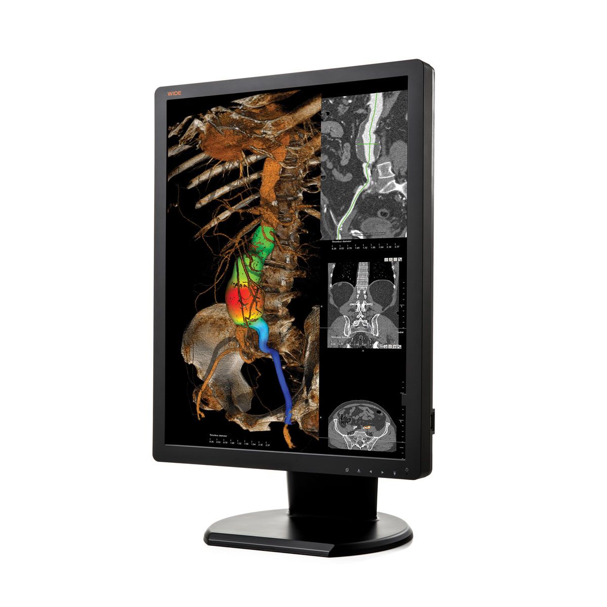 WIDE CX20N 2MP Diagnostic Radiology Monitor