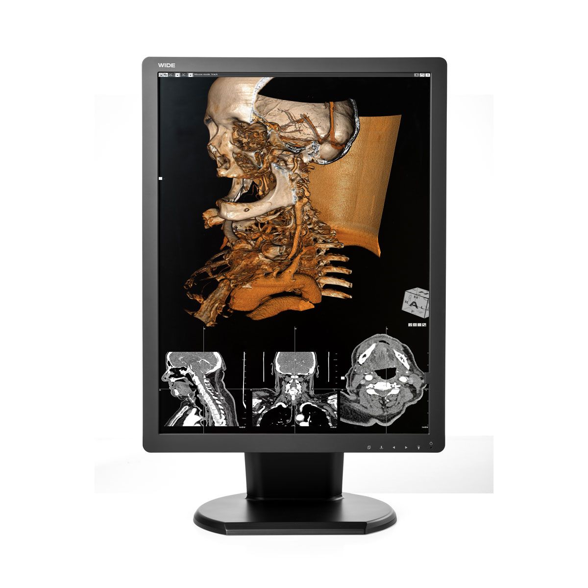 WIDE CX30N 3MP Diagnostic Radiology Monitor