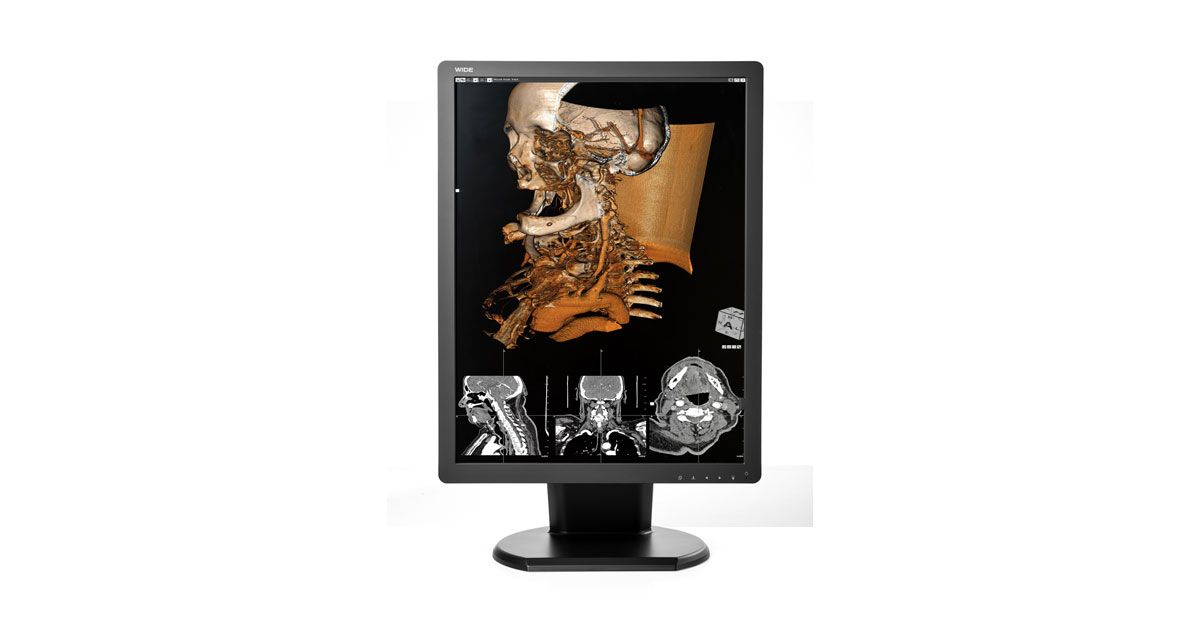 WIDE CX30N 3MP Diagnostic Radiology Monitor