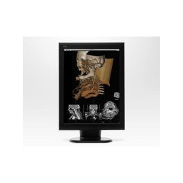 WIDE CX30p 3MP Diagnostic Radiology Monitor