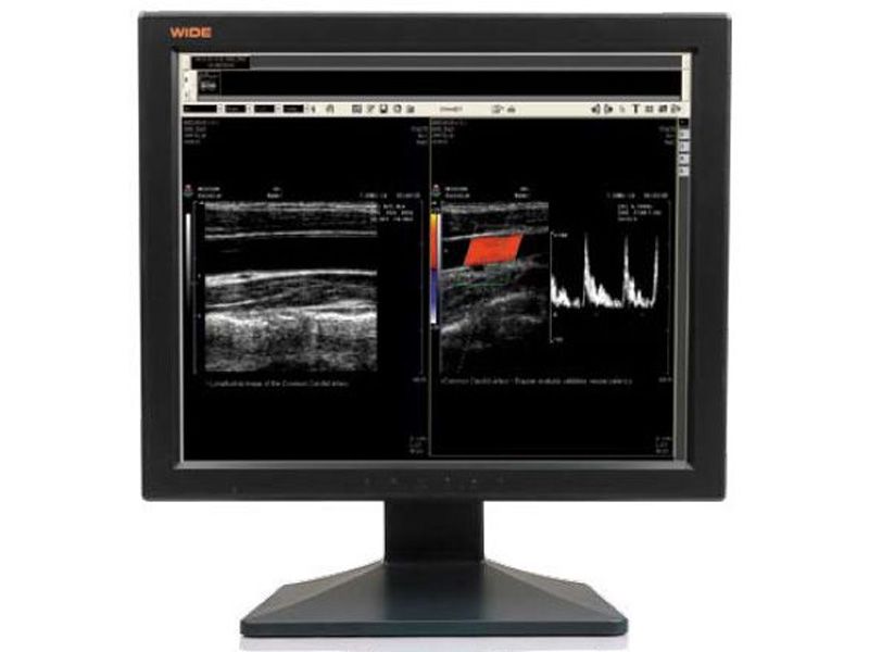 Multi-Modality Monitors