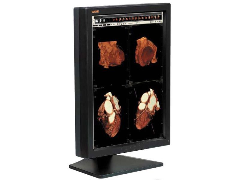 WIDE IF2103CP 3MP Diagnostic Radiology Monitor