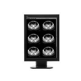 WIDE MX20s 2MP Diagnostic Radiology Monitor