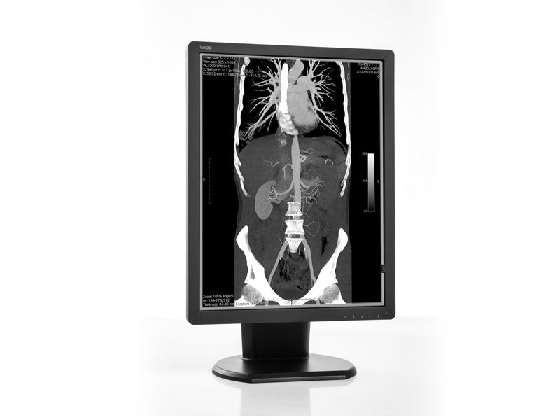 WIDE MX30N 3MP Diagnostic Radiology Monitor