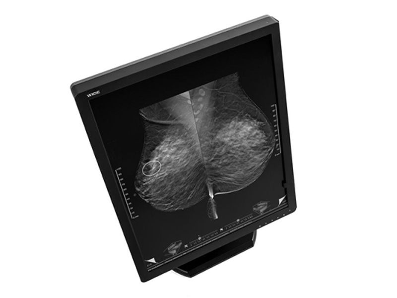 WIDE MX50N 5MP Mammo Tomosynthesis Diagnostic Radiology Monitor