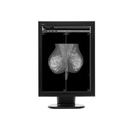 WIDE MX50p 5MP Diagnostic Radiology Monitor