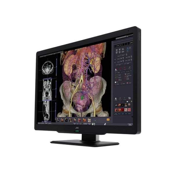 JVC CL-S600 6MP Diagnostic Radiology Monitor