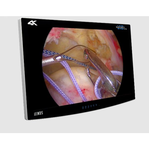 Monitor de Endoscopio Médico 4K UHD de 32 Pulgadas - DashTech