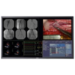 Barco MDSC8258 58 Inch Quad HD Surgical Display