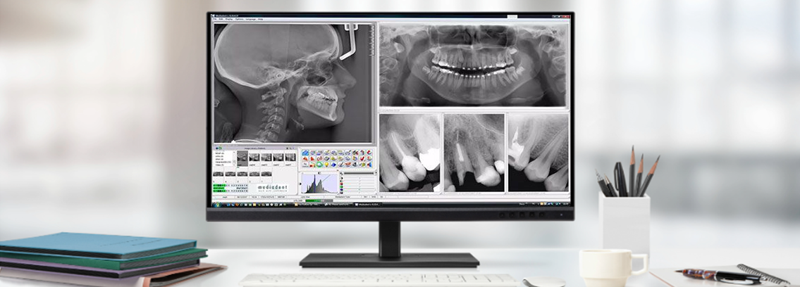 Dental Monitor Displays