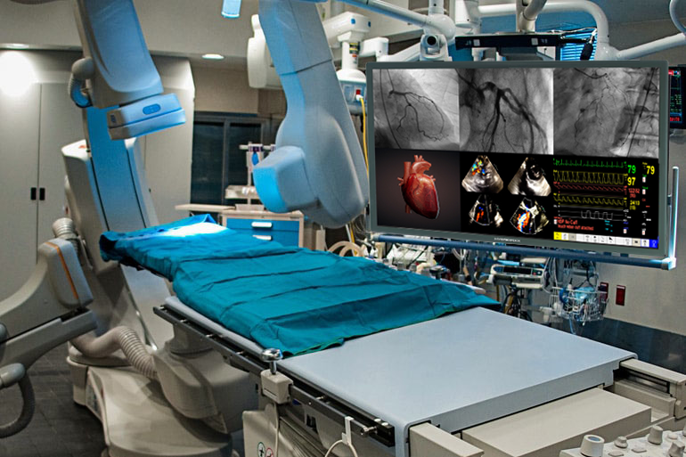 Cath Lab and Hybrid OR Display Monitor